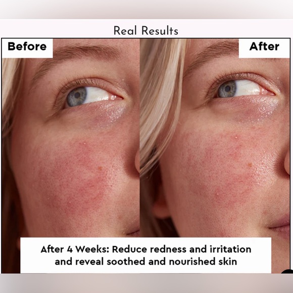 Glow Recipe Avocado Ceramide Recovery Serum (A1) - Picture 8 of 11